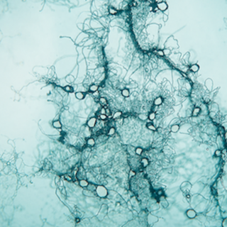 Anaerobic fungi-Microscope