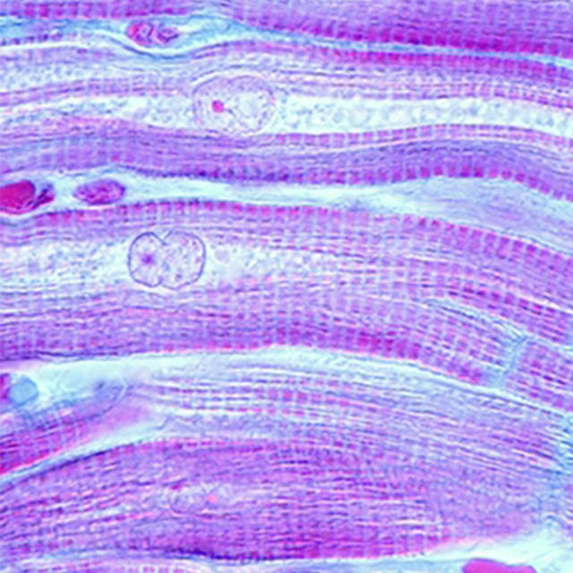 A microscopy image showing muscle fibers of heard myocardium