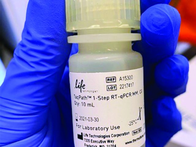 Testing for the novel coronavirus requires a series of reactions to find the virus's genetic material from a tissue sample  Photo Credit: