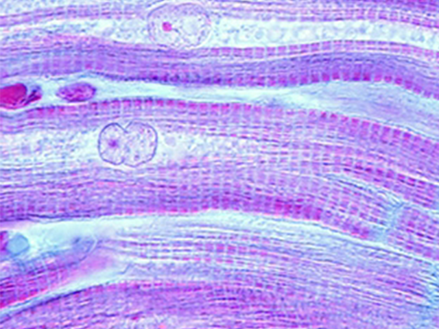 A microscopy image showing muscle fibers of heard myocardium